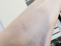 20180629 085036